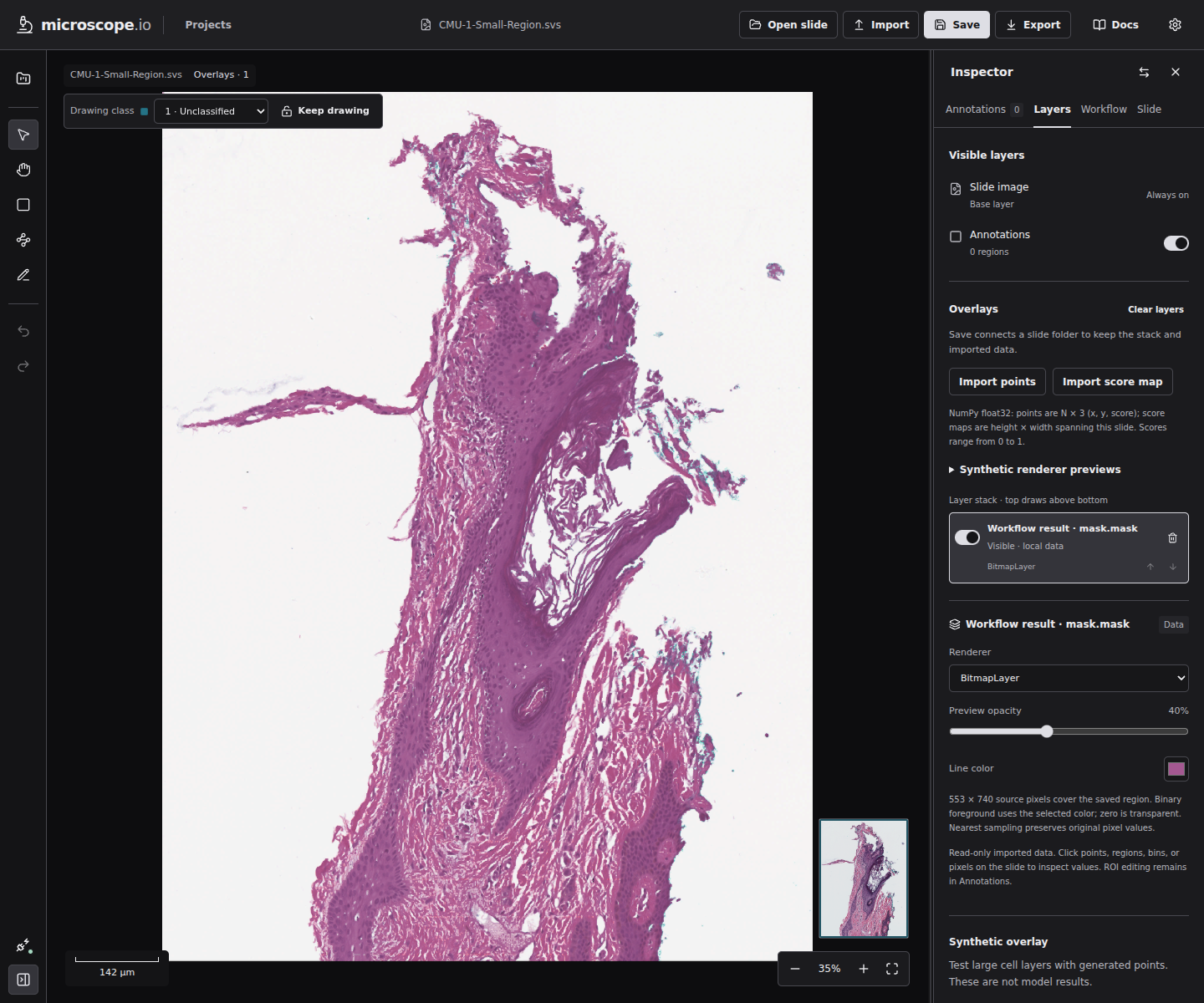 The resulting local binary mask layer overlaid on the public sample slide, with the Layers inspector open.